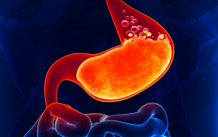 Gastric disorders