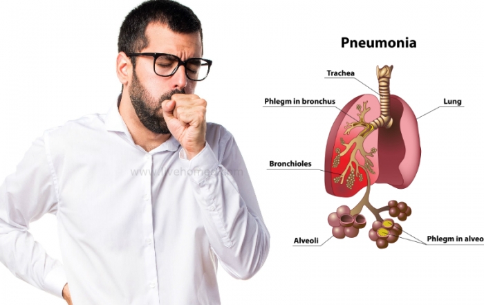 Pneumonia Disorder