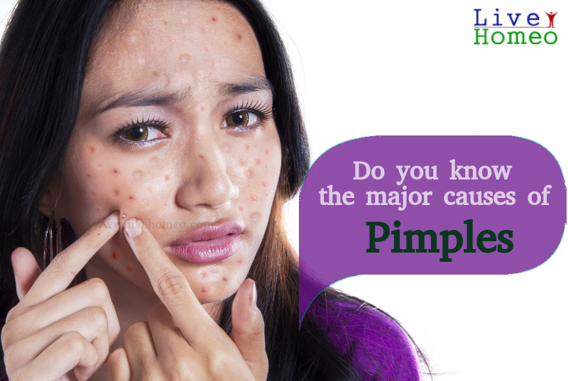 Pimples Problems