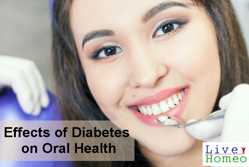 Effects of Diabetes on Oral Health