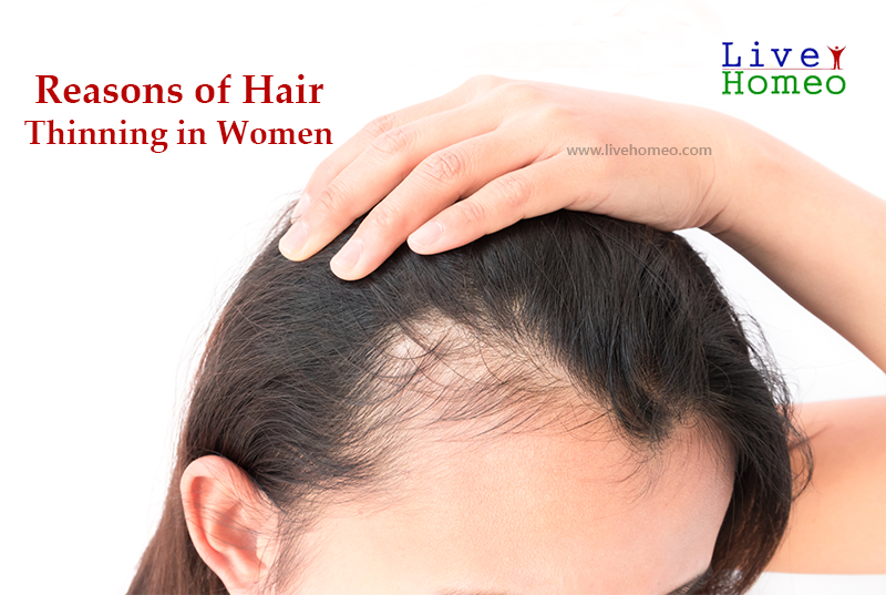 reasons of hair thinning in women