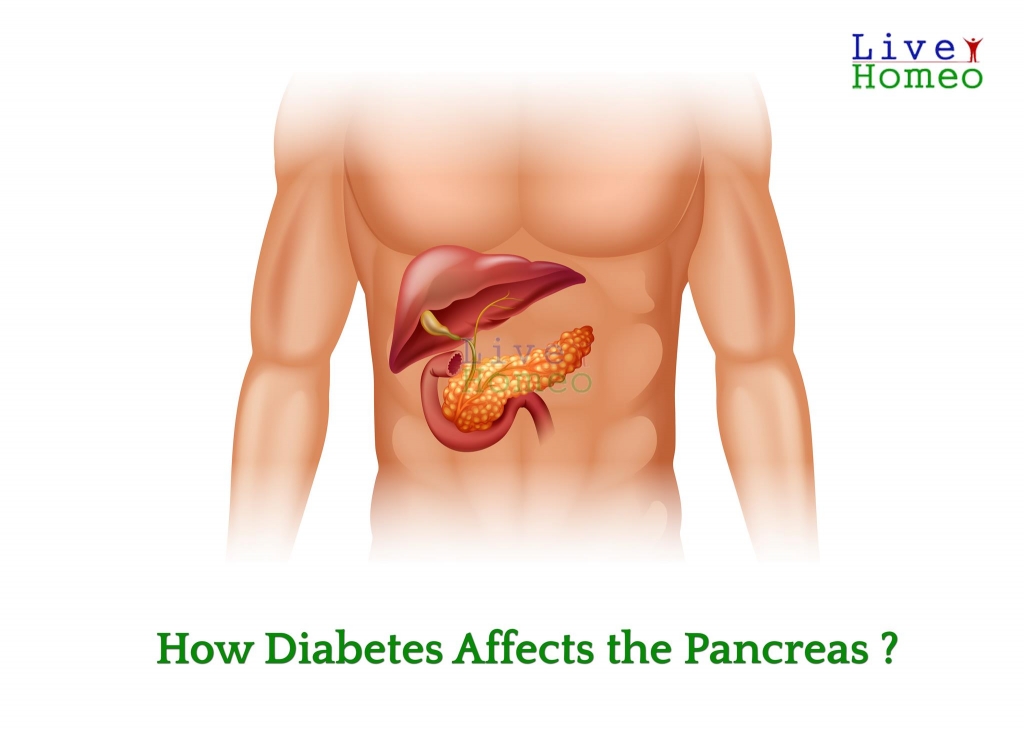 How Diabetes Affects the Pancreas