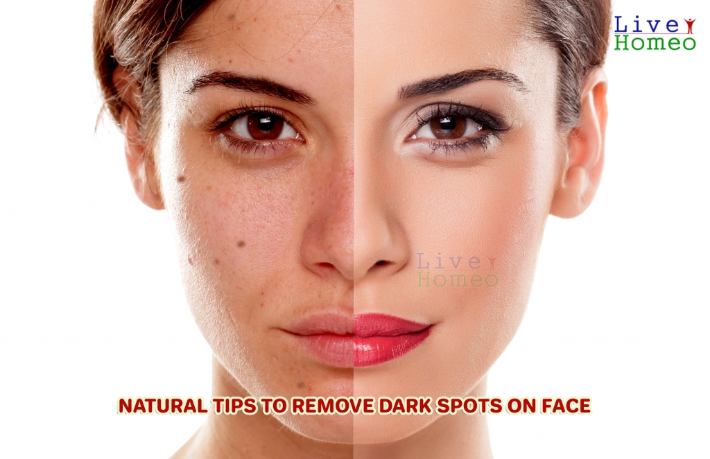 Natural tips to remove dark spots on face