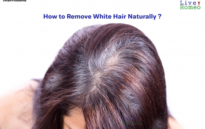 How to Remove White Hair Naturally