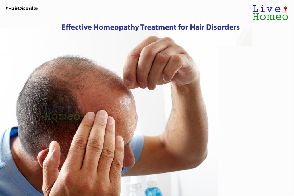 Effective Homeopathy Treatment for Hair Disorders